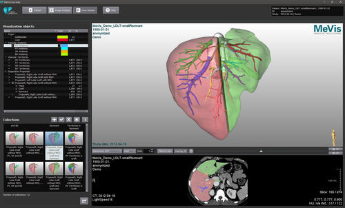 Software medico - MeVis  - VAREX Imaging - per tomografia computerizzata / MRI / per PACS
