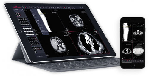 Applicazione web medica - MedDream - MEDDREAM - per radiologia / di visualizzazione / visualizzatore