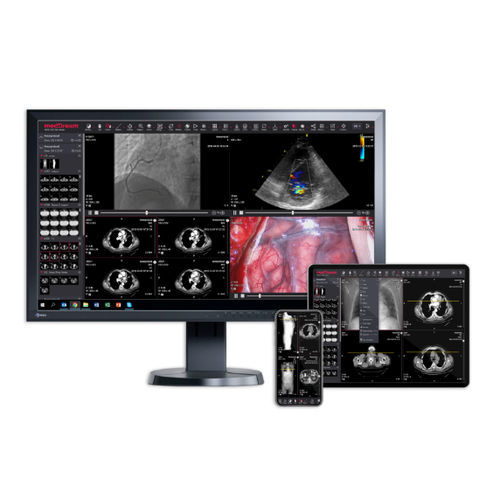 Applicazione web medica - MedDream - MEDDREAM - per diagnostica per immagini / per DICOM / di condivisione