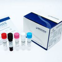 Kit di test della febbre dengue - GenoAmp&reg; GRA2006 - Medical Innovation Ventures - virale / di siero / al plasma
