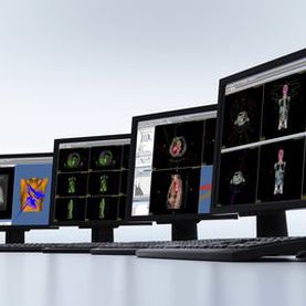 Software di visualizzazione - DICOM RT Studio - PTW Freiburg Physikalisch-Technische-Werkstätten - di trattamento / per radioterapia