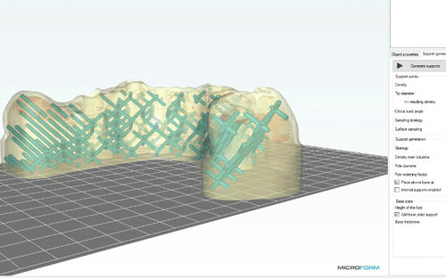 Software odontoiatrico -  MicroForm® - Microlay - di visualizzazione 3D / d’importazione / di stampa 3D