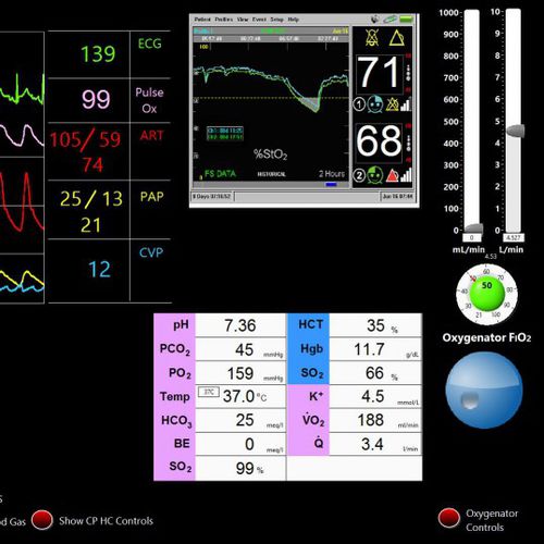 Simulatore per cure cardiopolmonari - Biomed Simulation Inc. - per cardiochirurgia / monitor / assistito da computer