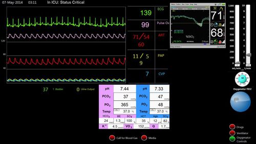 Simulatore di paziente per ECMO - Biomed Simulation Inc. - per cure cardiopolmonari / monitor / assistito dal calcolatore