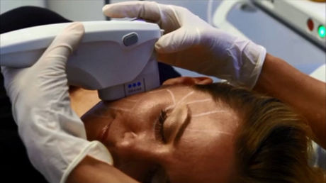 Unità di peeling ad ultrasuoni - Ultherapy® - Merz Pharma - unità di body contouring HIFU / su carrello
