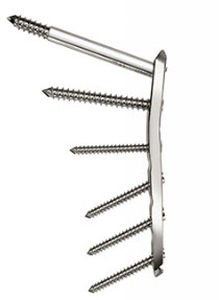 Placca di compressione per femore - Aconda  - Spinamer Health Products - per trocantere / prossimale / bloccata