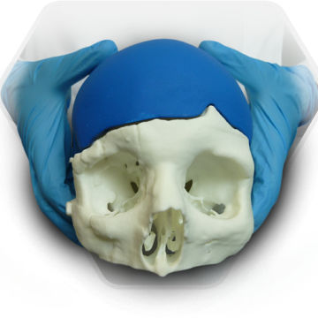Impianto cranico su misura - SkullPT  - 3D Side