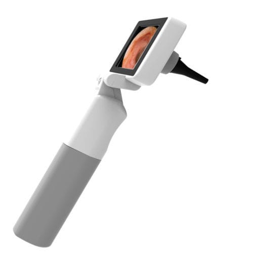 Videotoscopio con video monitor integrato - vOtsco - InfraEyes