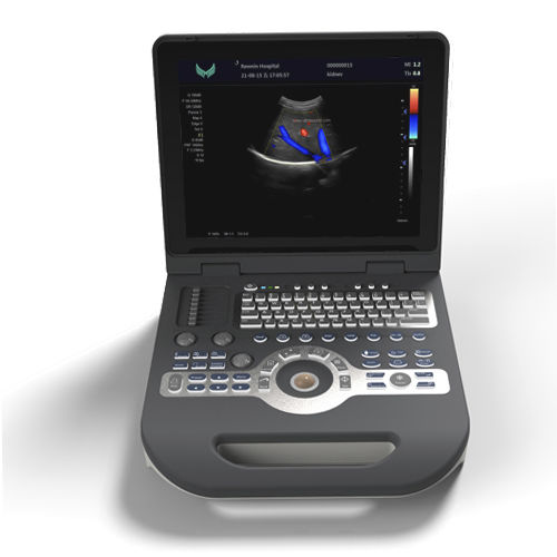 Ecografo portatile - XF3500 - Xianfeng Ultrasound Medical - per ecografia multidisciplinare / in bianco e nero / con doppler a colori