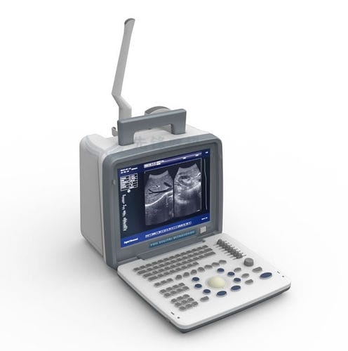 Ecografo portatile - XF300 - Xianfeng Ultrasound Medical - per ecografia multidisciplinare / in bianco e nero / con console integrata