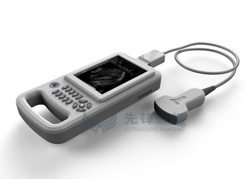 Ecografo palmare - XF20 - Xianfeng Ultrasound Medical - per ecografia multidisciplinare / in bianco e nero