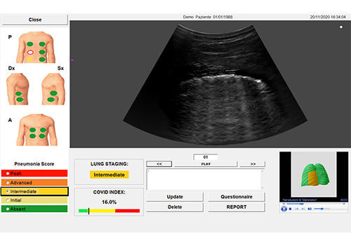 Software medico - SensUS Lung - Amolab - clinico / di analisi / di monitoraggio