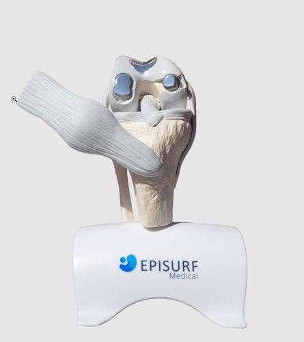 Impianto per ginocchio - Episurf Medical - anatomico / in cobalto-cromo