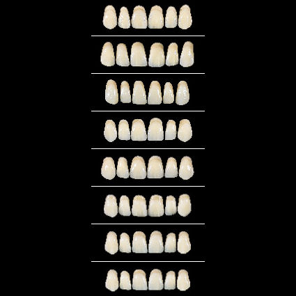 Protesi dentale in acrilico - Almamiss Upper  - Wiedent - per denti anteriori