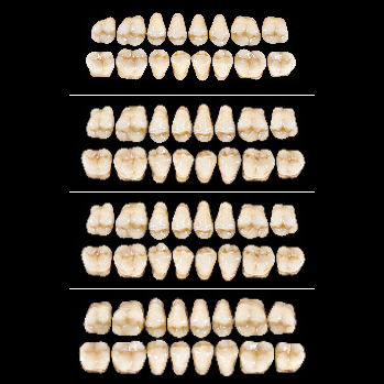 Protesi dentale in acrilico - Almamiss   - Wiedent - per denti posteriori