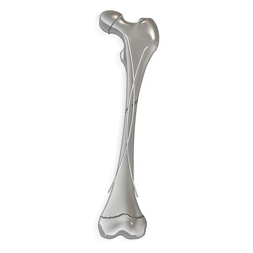 Chiodo intramidollare per femore - pediFlex™ - OrthoPediatrics - per tibia / per fibula / per omero