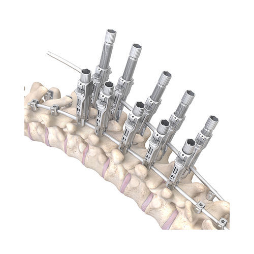 Sistema di osteosintesi toraco-lombare - RESPONSE™ 5.5/6.0 - OrthoPediatrics - via posteriore / pediatrico