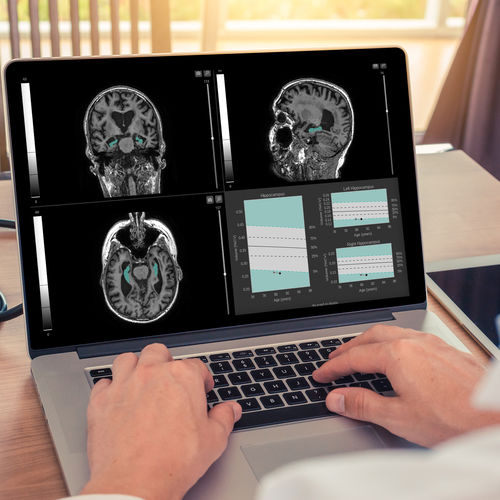 Software medico - QyScore® - qynapse - per ospedale / di analisi delle immagini / per reportistica