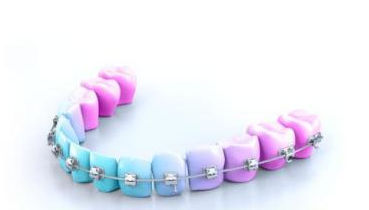 Filo ortodontico NiTi - BIO ACTIVE LIGHT - GC Orthodontics