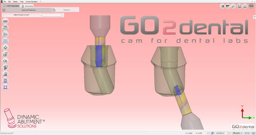 Software per laboratorio dentale - GO2dental - Dynamic Abutment Solutions - FAO