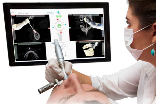 Sistema di navigazione chirurgica per chirurgia dentale - Inliant Dental Technologies Inc. - ottico