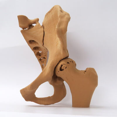 Modello anatomico osseo - 3D Lifeprints UK Ltd - di bacino / di anca / didattico