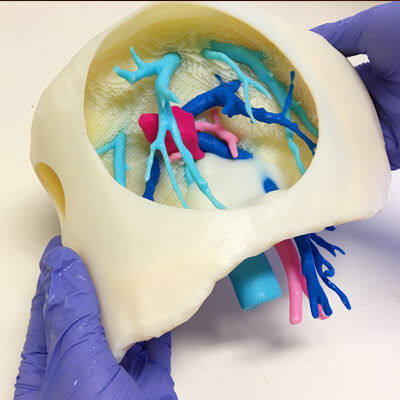 Modello anatomico di fegato - 3D Lifeprints UK Ltd - di arteria / di vena