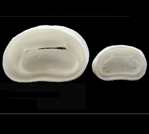Modello anatomico di valvola mitrale - 3D Lifeprints UK Ltd - per chirurgia robotica / didattico