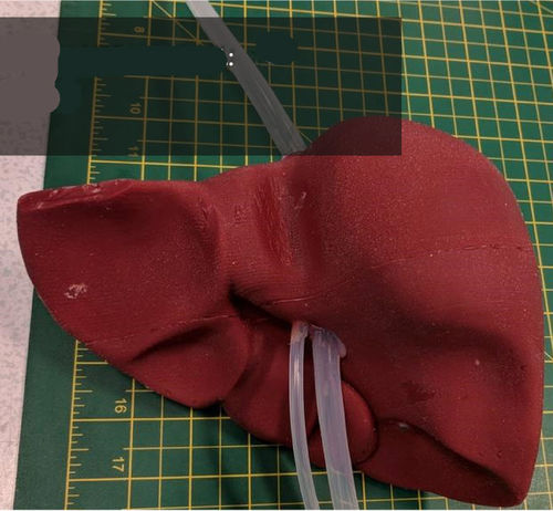 Modello anatomico di fegato - 3D Lifeprints UK Ltd - per chirurgia robotica / didattico