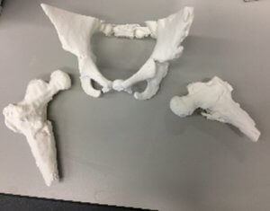 Modello anatomico osseo - 3D Lifeprints UK Ltd - di bacino / di femore / per chirurgia