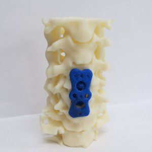 Modello anatomico di colonna vertebrale lombare - 3D Lifeprints UK Ltd - per chirurgia del rachide