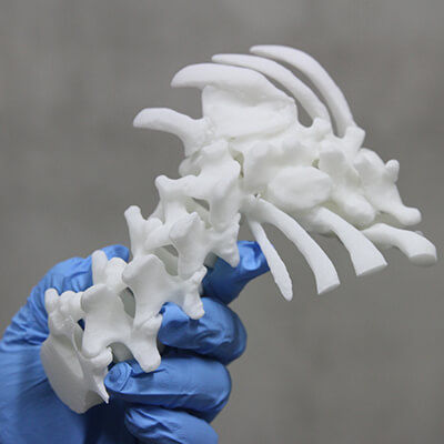Modello anatomico di rachide - 3D Lifeprints UK Ltd - per scoliosi