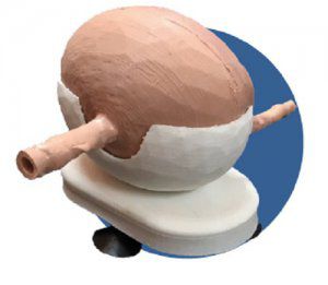 Modello anatomico vescica - 3D Lifeprints UK Ltd - per endoscopia
