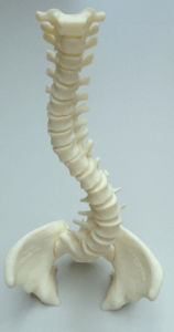 Modello anatomico di colonna vertebrale - 3D Lifeprints UK Ltd - per scoliosi