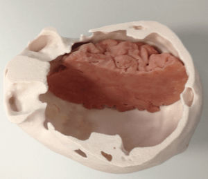 Modello anatomico di cranio - 3D Lifeprints UK Ltd - di cervello / per craniotomia