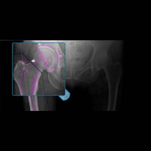 Software medico - OrthoView - Materialise UK - clinico / per chirurgia / di analisi