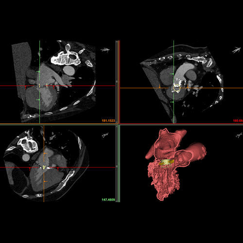 Software di visualizzazione 3D - Mimics Enlight - Materialise UK - medico / di anatomia / per tomografia computerizzata