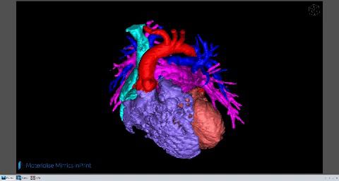 Software di stampa 3D - Mimics inPrint - Materialise UK - medico / chirurgico / di visualizzazione