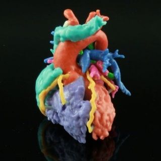 Software di stampa 3D - HeartPrint - Materialise UK - medico / di anatomia / di pianificazione