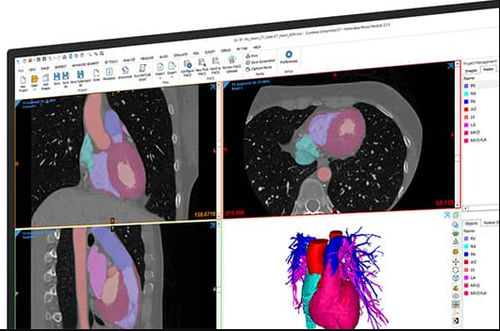 Software visualizzatore - Mimics  - Materialise UK - medico / clinico / di gestione