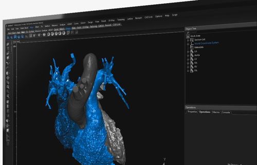 Software di visualizzazione 3D - 3-matic  - Materialise UK - medico / di anatomia / di progettazione