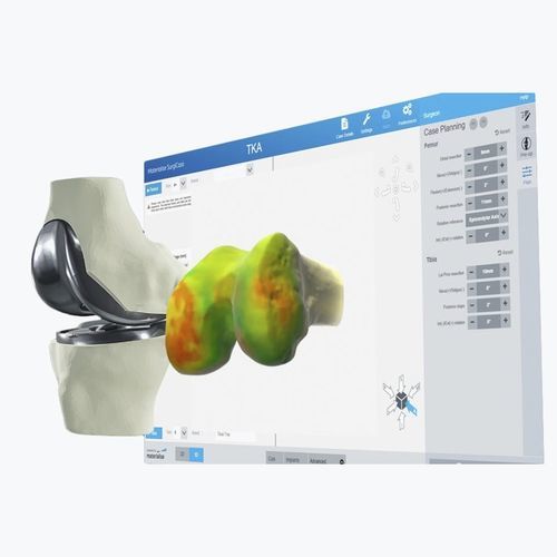 Software chirurgico - Materialise UK - preoperatorio / di visualizzazione 3D / di pianificazione
