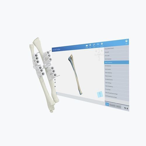 Software di analisi - Materialise UK - di pianificazione preoperatoria / medico / clinico