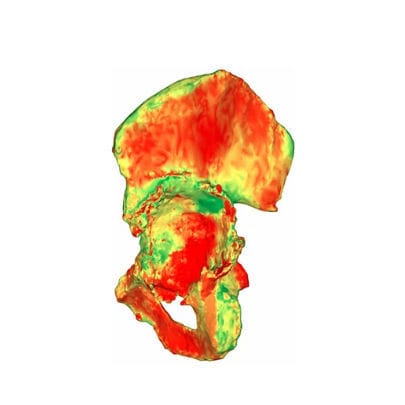 Software medico - aMace - Materialise UK - clinico / per tomografia computerizzata / per chirurgia