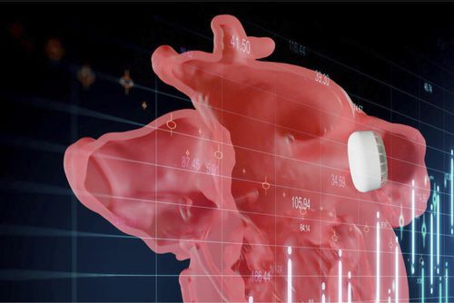 Software medico - Enlight LAAO - Materialise UK - di anatomia / per tomografia computerizzata / visualizzatore
