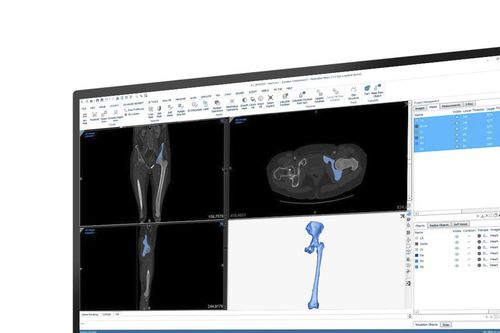 Software medico - Mimics - Materialise UK - clinico / di anatomia / di misura