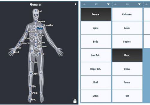 Software di gestione - DxWorks - New Medical Imaging - di acquisizione / di post elaborazione / per radiologia
