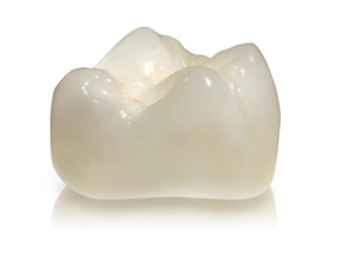 Corona dentale in zircone - DIAMOND - Derby Dental - per denti posteriori / traslucido