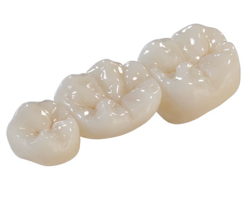 Ponte dentale in zircone - DIAMOND - Derby Dental - per denti posteriori / traslucido