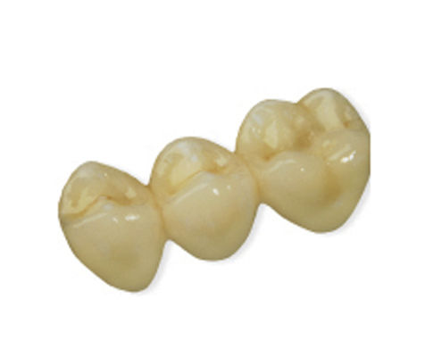 Ponte dentale in PMMA - CAD Temp  - Derby Dental - per denti anteriori / per denti posteriori